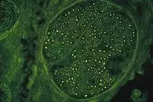 HIV-induced autoimmun-antiMyelin Antibodies against human nerve tissue (FITC-Stain).jpg