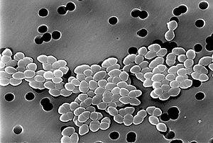 Vancomycin-Resistant Enterococcus 01.jpg