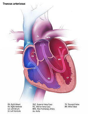 Truncus arteriosus.jpg