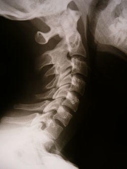 Radiology 1300594 Nevit.jpg