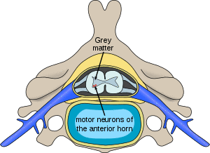 Polio spinal diagram-en.svg