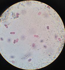Chromatium Okenii al microscopio.jpg