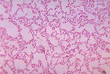 "Bacteroides biacutis" anaerobically cultured in blood agar medium