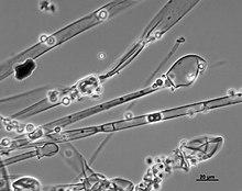 Mucor racemosus sporangiophore.jpg