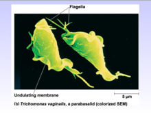 "T. vaginalis" Colorized SEM