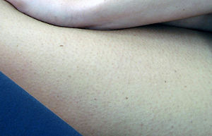 Female skin large.jpg
