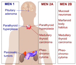 Multiple endocrine neoplasia.png