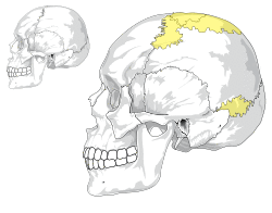 Wormian bones.svg
