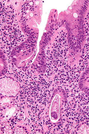 Strongyloides - very high mag - 2.jpg