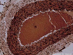 Rabbitarteriole100x1.jpg