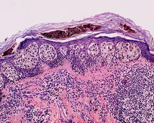 Skin Tumors-450.jpg