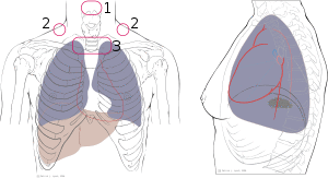 Thoracic landmarks anterior view lung ausc.svg