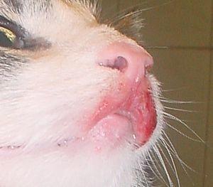 Eosinophiles Granulom.jpg