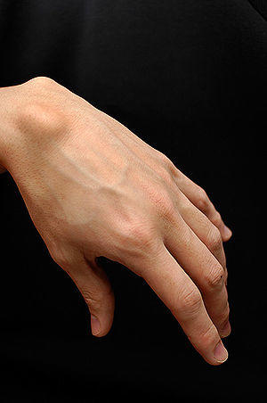 Ganglion-cyst.jpg