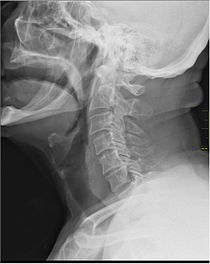 Medical X-Ray imaging EJE04 nevit.jpg