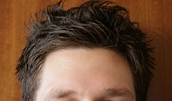 Male forehead-01 ies.jpg