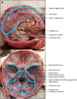 Dural venous sinuses.png