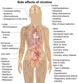 Possible side effects of nicotine include increased clotting tendency, atherosclerosis, enlargement of the aorta, bronchospasm, muscular tremor and pain, gastrointestinal nausea, dry mouth, dyspepsia, diarrhea, heartburn, peptic ulcer, cancer, lightheadedness, headache, sleep disturbances, abnormal dreams, irritability, dizziness, blood restriction, increased or decreased heart rate, increased blood pressure, tachycardia, more (or less) arrhythmias, coronary artery constriction, coronary artery disease, high insulin, insulin resistance, and risks to child later in life during pregnancy include type 2 diabetes, obesity, hypertension, neurobehavioral defects, respiratory dysfunction, and infertility.