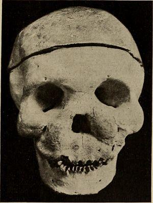 Nervous and mental diseases (1908) (14591670608).jpg