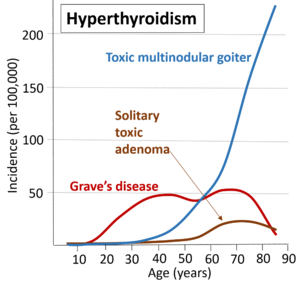 Causes of hyperthyroidism.png