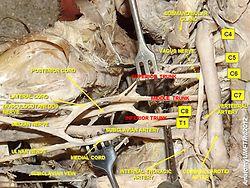 PLEXUS BRACHIALIS.jpg