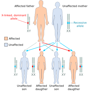 X dominant affected father.svg
