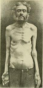 Internal medicine; a work for the practicing physician on diagnosis and treatment, with a complete Desk index (1920) (14598402017).jpg