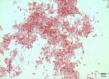 Photorhabdus luminescens (01).tif