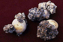 Synchytridium endobioticum.jpg