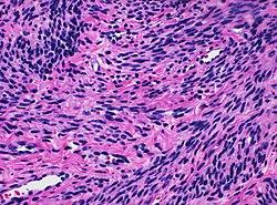 Histology of postmenopausal myometrium, intermediate magnification.jpg