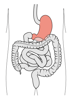 Tractus intestinalis ventriculus.svg