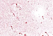 Vibrio cholerae 01.jpg
