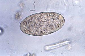 Fasciolopsis buski egg 08G0039 lores.jpg