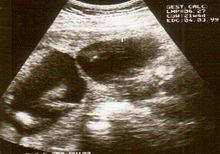 Ultrasound Scan ND 008.jpg