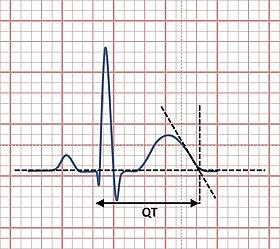QT interval.jpg