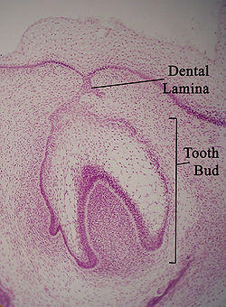 Dentallamina11-17-05.jpg