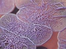 Burkholderia thailandensis (3444954404).jpg