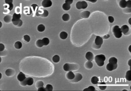 Vibrio harveyi.png