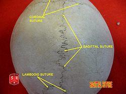Sagittal suture 2.jpg