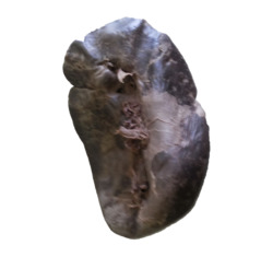 Visceral surface of Human Spleen.png