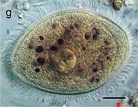 Balantidium coli trophozoite.jpg