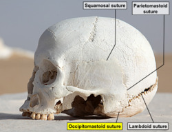 WhiteDesertSkullCropped - Occipitomastoid suture.png