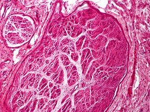 Skin Tumors-PA291026.jpg