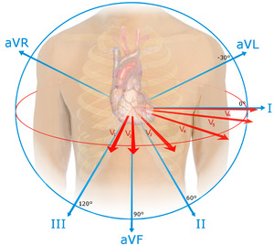 EKG leads.png