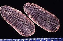 Pecopteris villosa.jpg