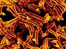 Mycobacterium tuberculosis MEB (1).jpg
