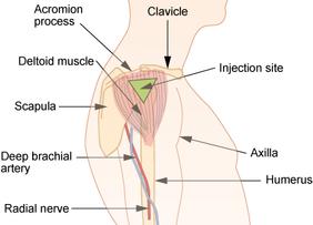Deltoid site