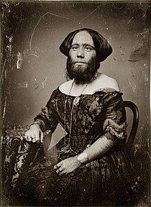 Josephine Clofullia. (Madame Clofullia, P.T. Barnum's "Bearded Lady of Geneva").jpg