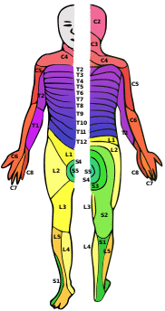 A person with dermatomes mapped out on the skin