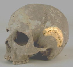 CraneoMuseoAlmeria cropped - Squamosal suture.png